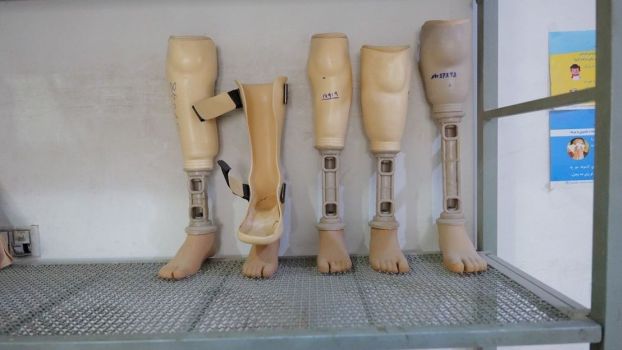 Prothèses fabriquées dans le centre de réadaptation de HI à Kandahar en Afghanistan (photo d'archive); }}