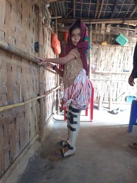 Dans un abri, une adolescente portant deux orthèses se soutient grâce à une rampe fabriquée en bambou. 