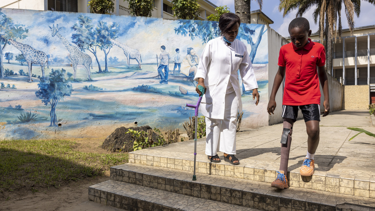 En 2022, grâce au soutien de HI, Dieudonné a obtenu une prothèse et bénéficie actuellement de séances de réadaptation aux Cliniques Universitaires de Kinshasa.