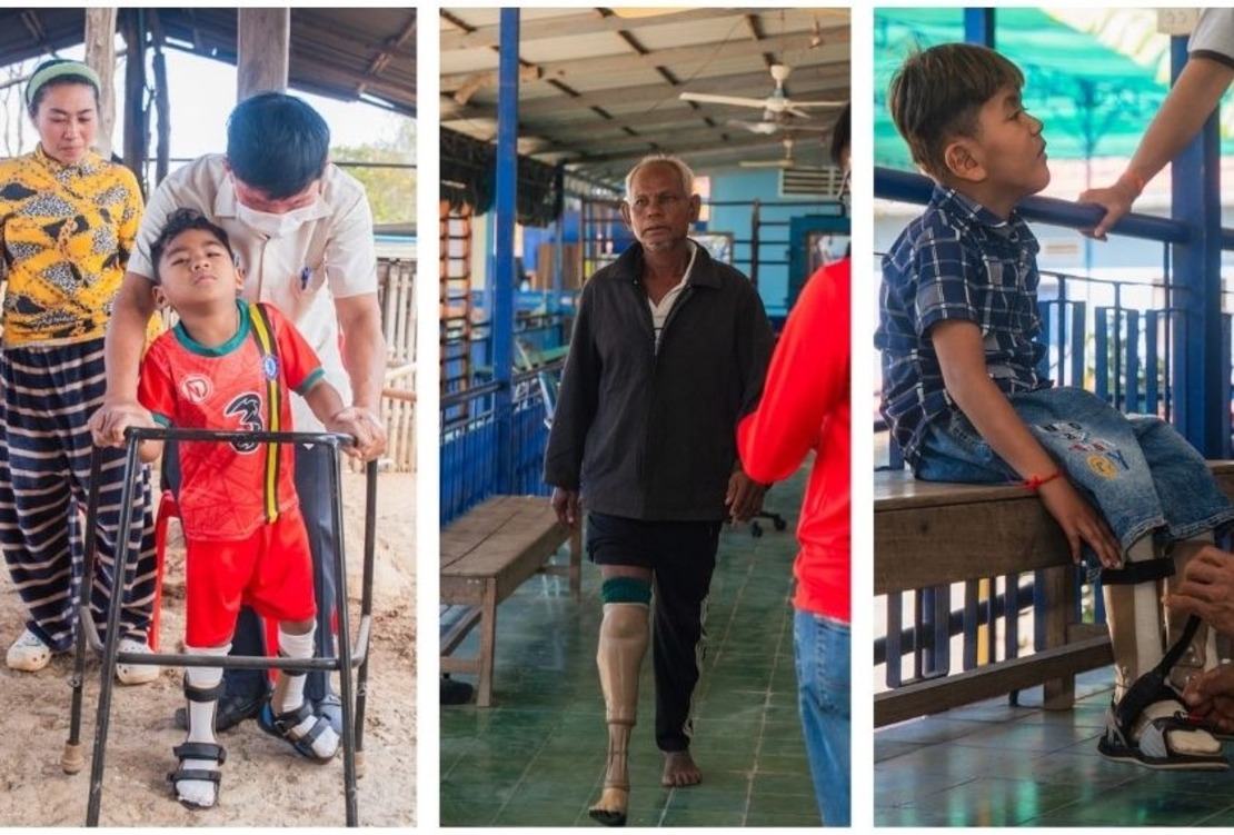 de gauche à droite, Chev, Davit et Thum lors de leurs séances de réadaptation à domicile ou au centre de réadaptation de HI à Kampong Cham photo montage où on voit les trois patients du centre marcher grâce à leur appareils d'assistance; }}