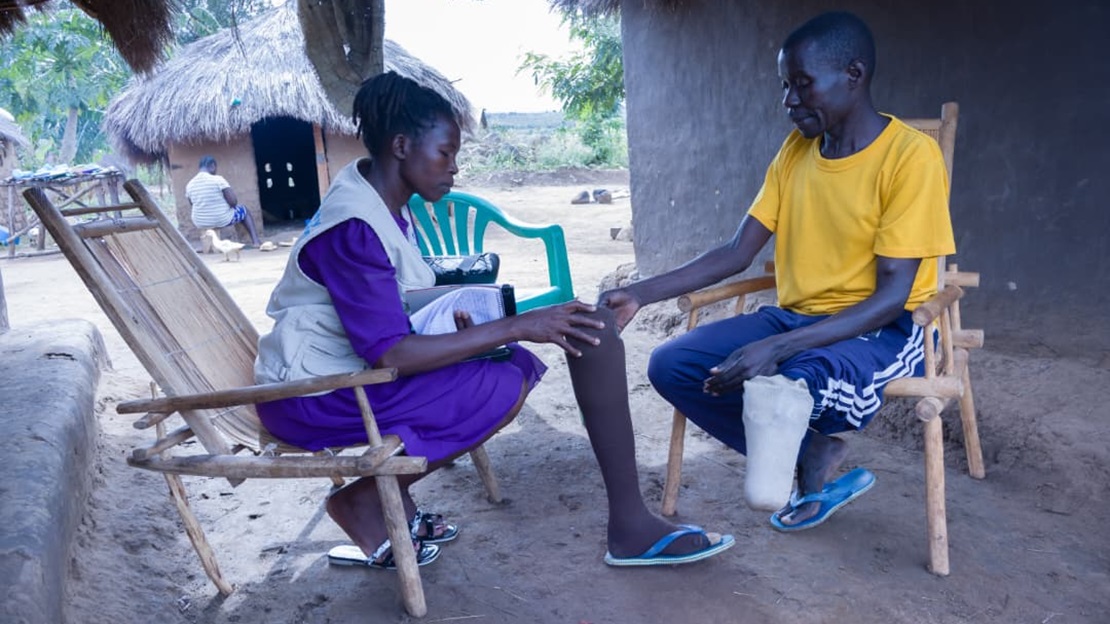 An HI worker and a man are sitting down, discussing the man’s prosthesis.; }}