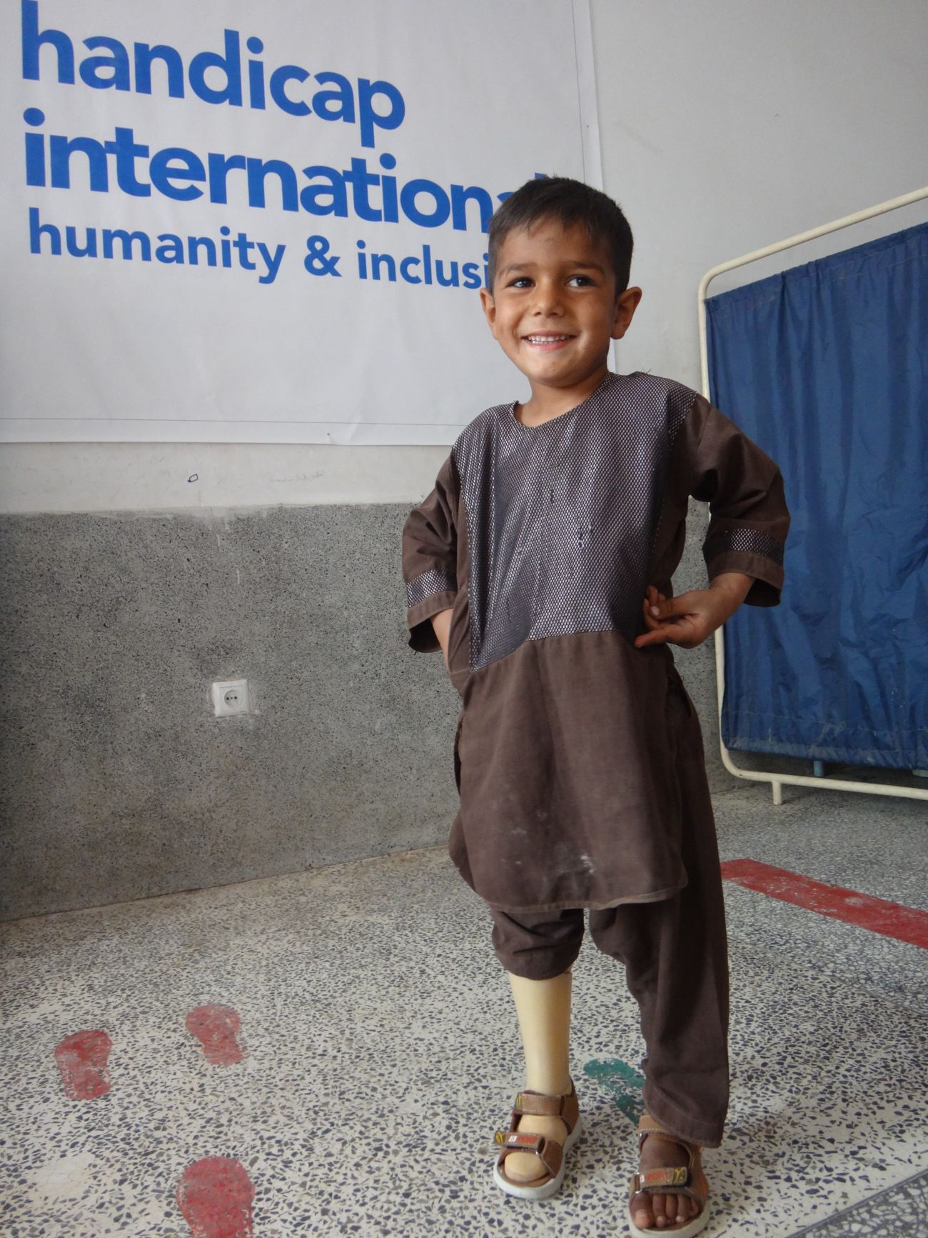 Enayatullah with his prosthesis.